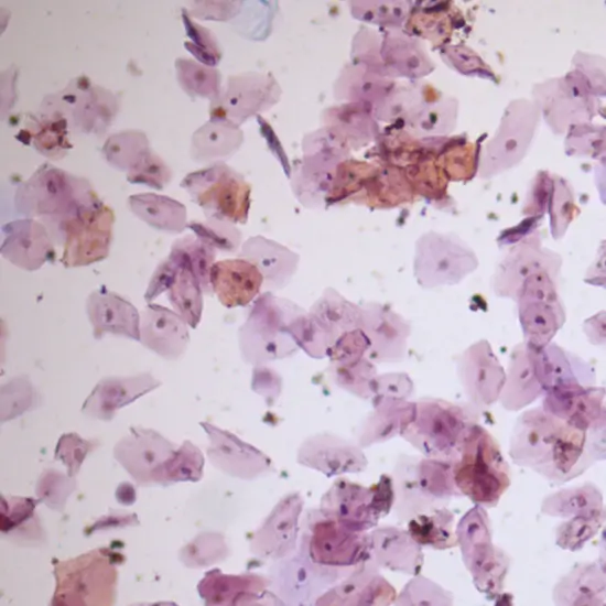 urine routine and microscopy test